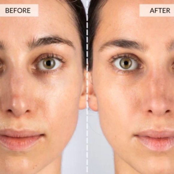 CurrentBody Skin LED Light Therapy Face Mask The world’s most powerful anti-agin - Picture 9 of 16